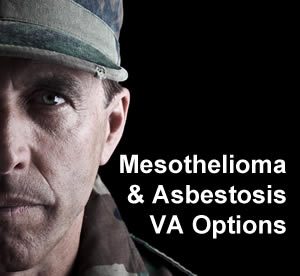 mesothelioma-va-treatment2